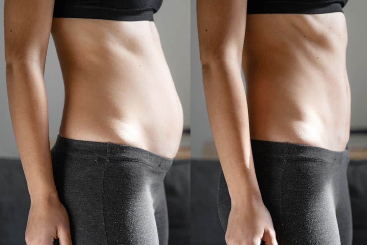 Post-Pregnancy: What Happens to Your Abdominal Muscles After Birth Radlett