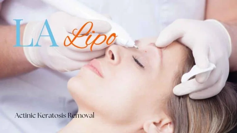 Woman receiving Actinic Keratosis Removal Treatment Radlett