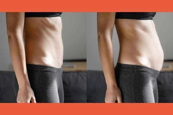 LA-EMS Body Sculpting results Radlett
