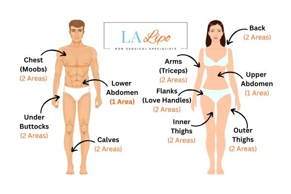 LA LIPO Cryolipolysis Areas Radlett