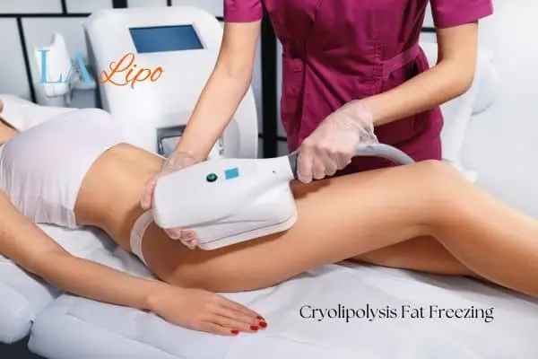 Woman receiving coolsculpting Radlett treatment on her thighs