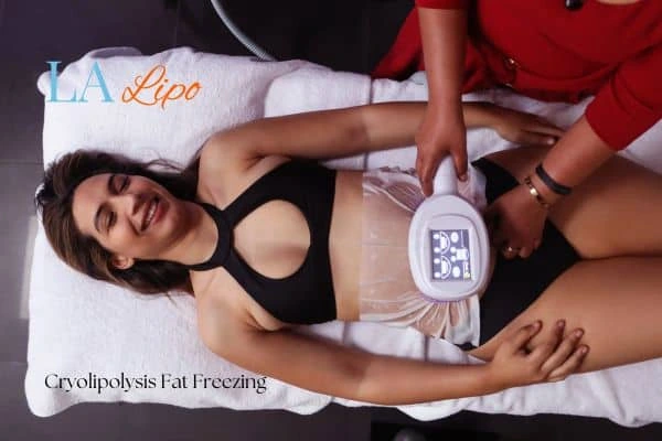 woman getting cryolipolysis Radlett
