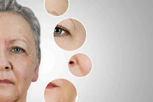 HIFU Facelift Radlett from LA LIPO