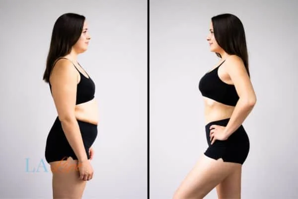 link between body image and mental health Radlett