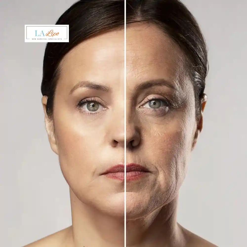 How Can You Tell If Non-Surgical Skin Tightening Is Right for You Radlett?