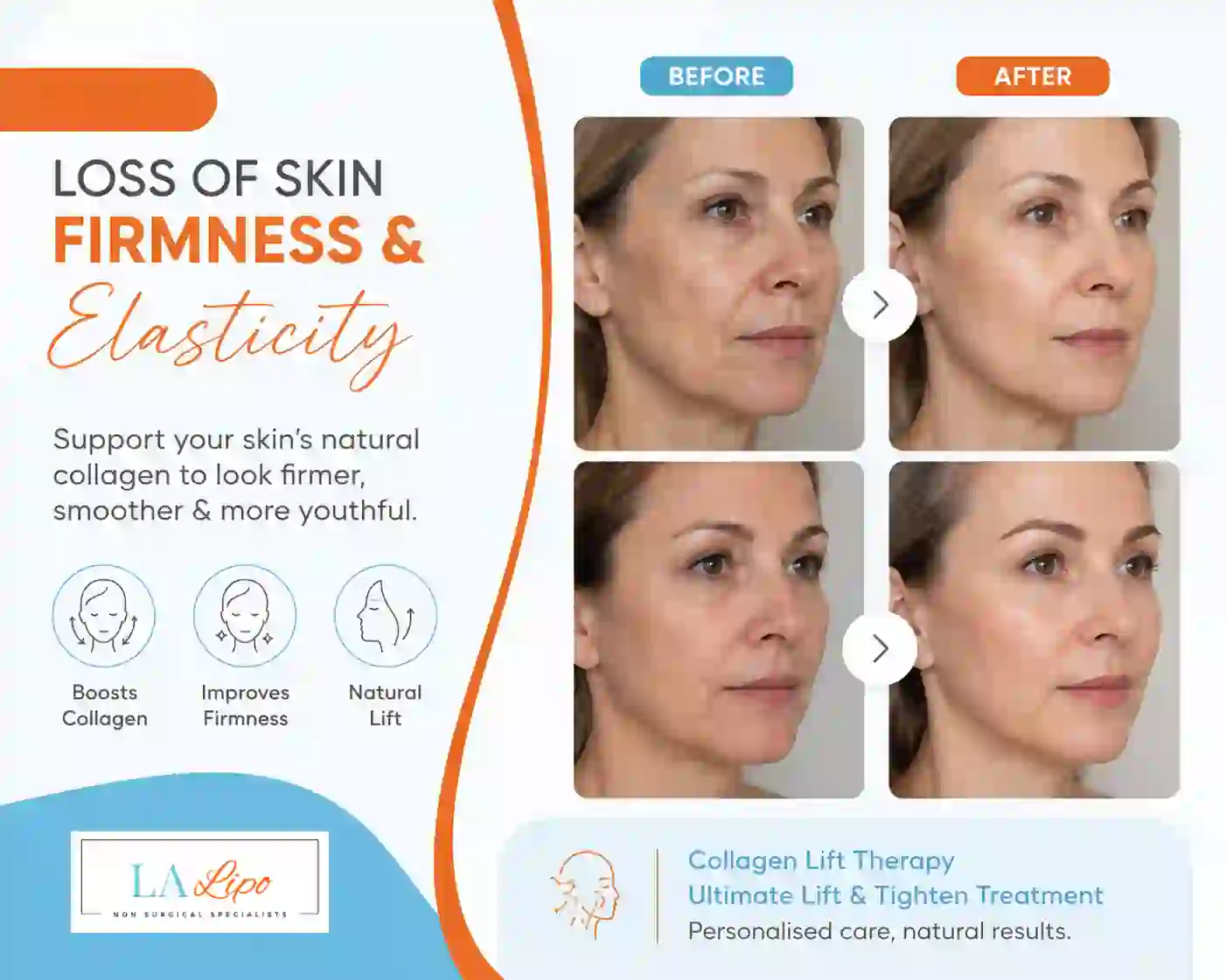 Sign #7: Loss of Skin Firmness and Elasticity Radlett